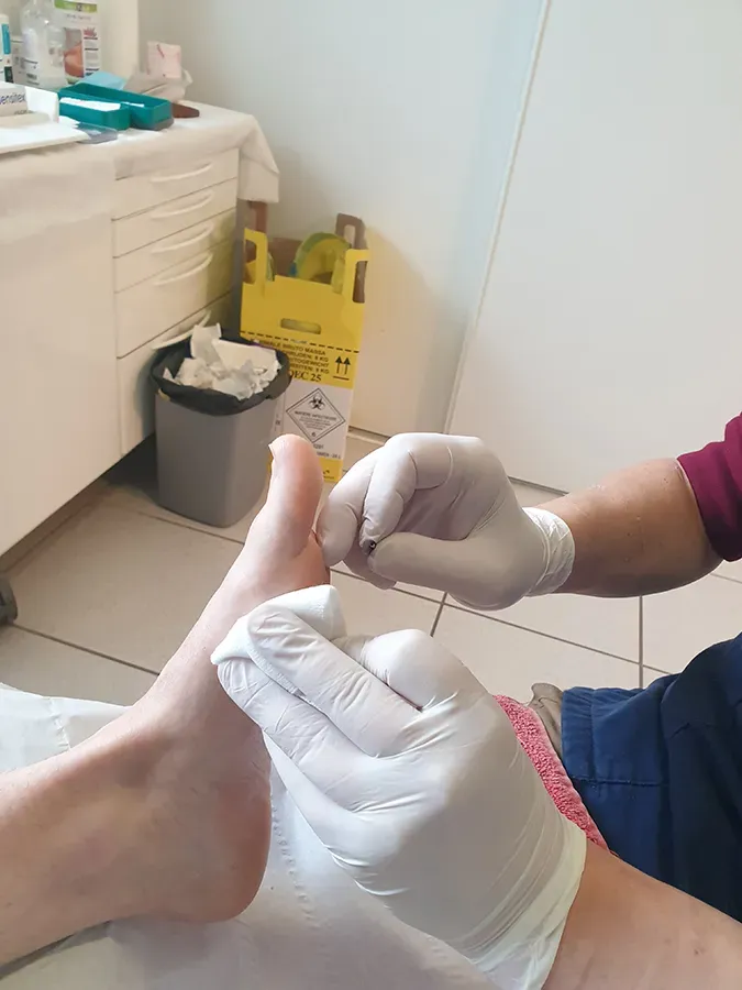 Soin de podologie